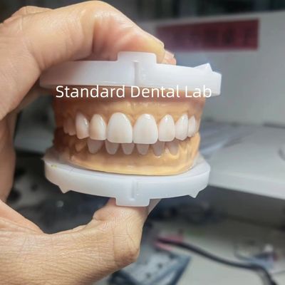 Perfecte esthetiek Voorlopige was voor tandartsen die tandwas gebruiken van China Dental Lab