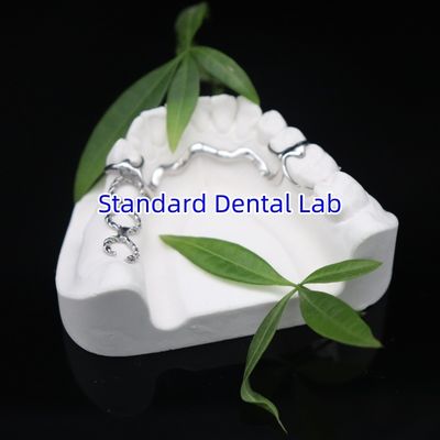 Vitallium 2000 gedeeltelijk kader ISO CE en FDA China tandheelkundig laboratorium metaal framewrok gedeeltelijke prothese