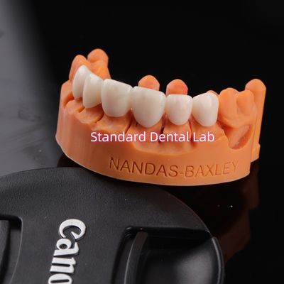 Comfort en functionaliteit met digitaal CAD CAM tandheelkundig laboratorium Translucent gelaagde Zirconia brug