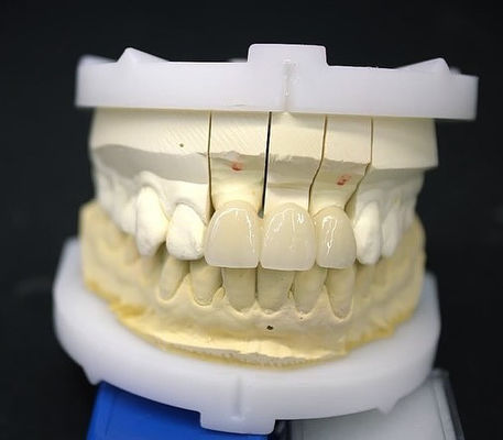 Precise Zirconia Crown Bridge Comfortabele pasvorm / esthetiek 3-4 dagen Snelle levertijd