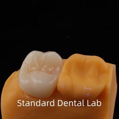 5 jaar garantie volledige contour Zirconia kroon voor kiezen tanden Noritake porselein gemaakt in door betrouwbare tandheelkundige laboratorium