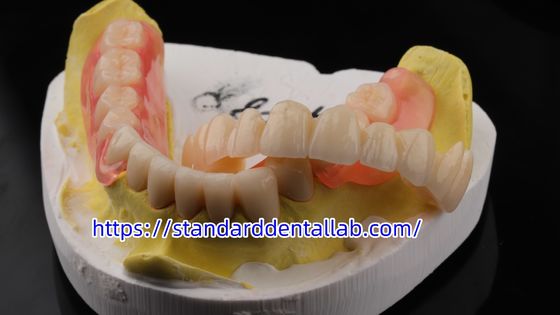 Hoge esthetiek tandheelkundige TCS Valplast Flexible partiële tandheelkundige tandheelkundige laboratorium Valplast Clamps Roze tint