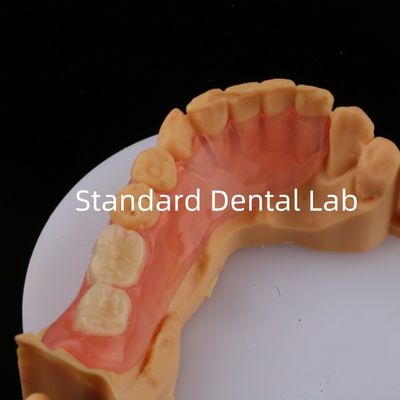 Ace Teeth Roze/donker TCS Valplast Flexible partiële tandheelkundige prothesen voor een hoge esthetiek
