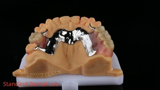 CorCr Metalen gedeeltelijke tandheelkunde Hoge licht Berylliumvrij Ivoclar Scheftner Comfortabel metalen framewrok