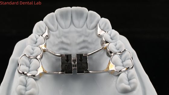 Boogtandpale expander Stabiel Hyrax Palatal expander Perfect Fit SDL Tandheelkundige Lab Orthodontie Apparaat