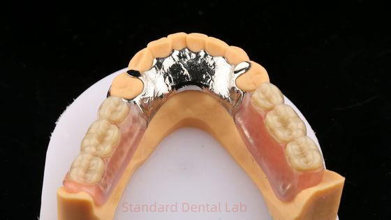 Metalen legeringen Cobalt Chroom Gedeeltelijke prothese Ivoclar Scheftner Comfortabel gegoten metaal Framewrok