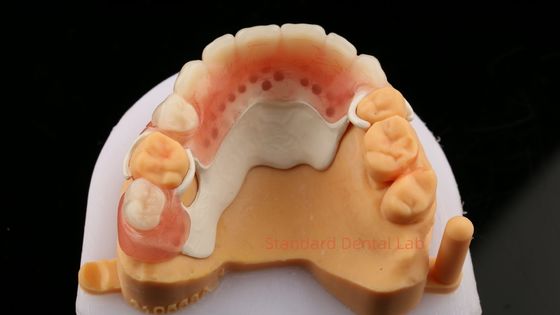 Peek Partial Frame Design ISO CE And FDA Dental Lab Acrylisch Partial Prothese Frame