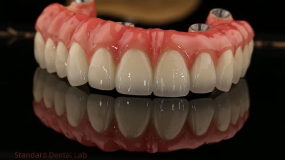 Full Arch Zirconia Implantaten Brug Zirconia Crown Vita Schaduw Op maat All On Four / Six Tandheelkundige Implantaten