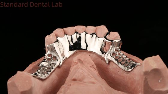 Cobalt Chrome Gegooid Metalen Frame Gedeeltelijke Tandheelkundige Prothesen Met Onderste Schort Design SDL Tandheelkundige Lab