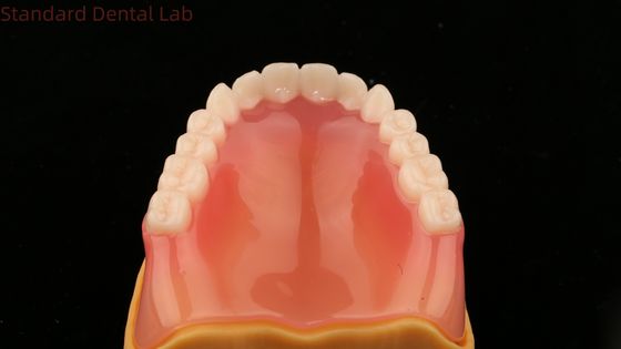 Volledige tandheelkunde Ivoclar Volledige tandheelkunde Acryl tanden SDL tandheelkundig laboratorium