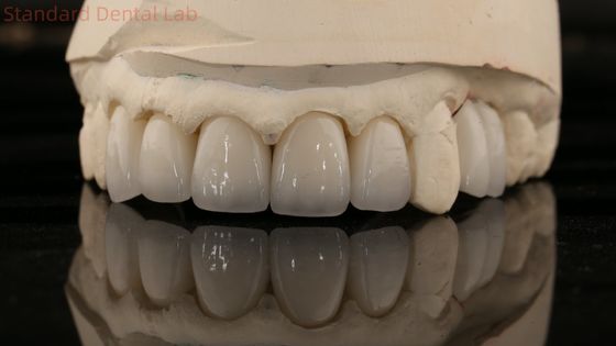 China Dental Lab Zirconia Full Contour Crown High Aesthetic Natural Dental Bridge 5 jaar garantie
