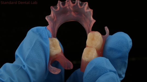 Tandheelkundige TCS Valplast Flexible Partial Protheses Nesbit Valplast Finish China Dental Lab Valplast Clamp