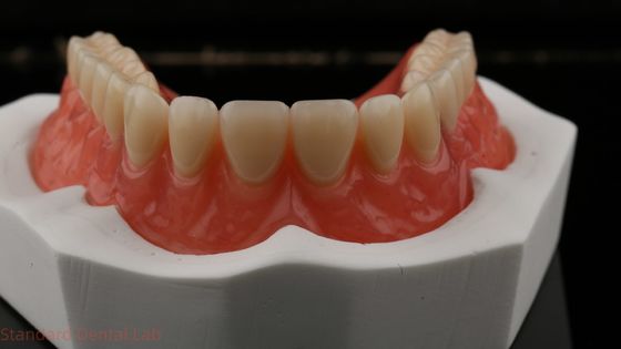 Dentsply Lucitone 199 Acrylprothese voor een natuurlijke look