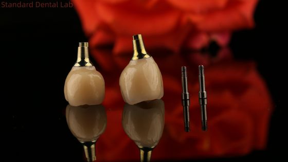 Porselein Zirconia Cement Retined Schroef Implant Hexagonale hoofdvorm voor Custom Fit Esthetics