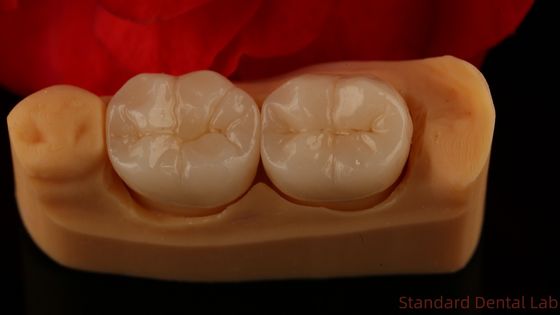 Volledige contour Zirconia kroon Uitzonderlijke sterkte en esthetiek Geen porseleinen overlay Achterkroon China tandheelkundig laboratorium