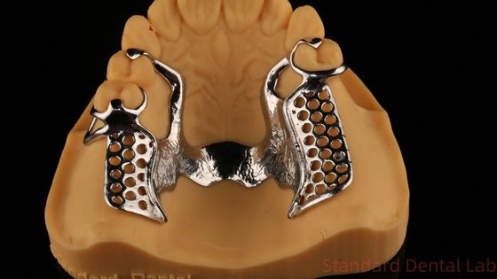 Metalen legeringen gedeeltelijk Cobalt Chroom Prothesen Ivoclar Scheftner Comfortabel China Tandheelkundig Lab