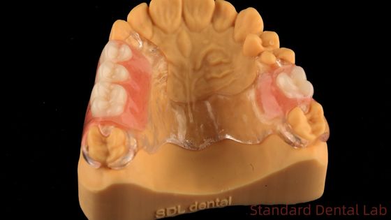 Flexibel helder gegoten metaal frame gedeeltelijke gebit hoge esthetiek perfecte pasvorm