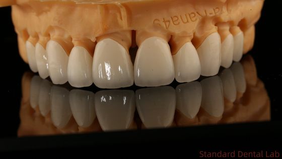 Volledige contour tandheelkundige lab kronen hoge doorzichtigheid solide zirconia kroon China tandheelkundige lab