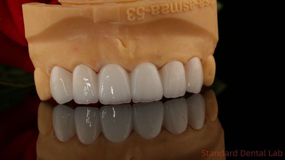 Volledige contour Zirconia kroon doorzichtigheid 3D PRO Geen porseleinen overlay Standaard tandheelkundig laboratorium