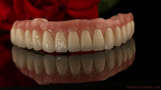 Zirconia Titanium Tand Implantaten Alle op 4 Volledige boog Tanden Vervanging 3-6 maanden Genezingstijd