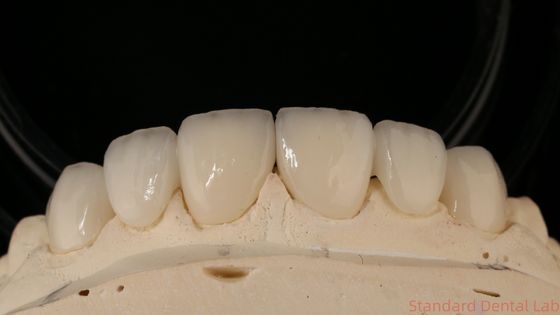 Precise Zirconia Crown Bridge Comfortabele pasvorm / esthetiek 3-4 dagen Snelle levertijd
