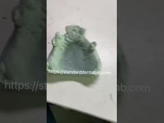 Fast and Cast Frame Co-Cr Metal Partial Denture Framework voor tandartsen