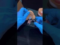 Duidelijk kader Acryl metaal gedeeltelijke gebit frame High esthetiek China tandheelkundig laboratorium