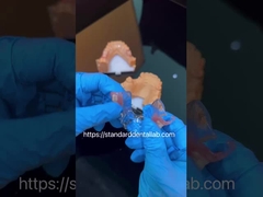 FDA Cobalt Chroom Hoog esthetisch helder raam gedeeltelijk