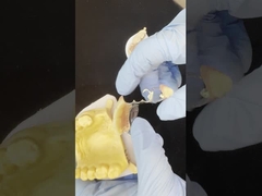 Aanpasbaar Cobalt Chrome Cast Frame met zeer goede stickers