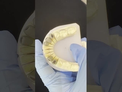 Metalen gegoten post kern kroon Cocr Accurate Retentive Full Zirconia Bruxier