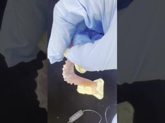 Flexible Valplast-prothesen voor natuurlijk comfort en esthetische kwaliteit