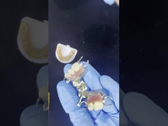 Aanpasbaar Cobalt Chrome Cast Frame met zeer goede stickers