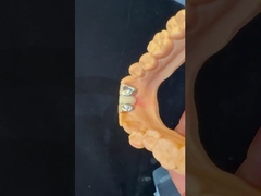 Tandheelkundige Tanden PFM Maryland Bridge High Esthetics FDA Certified