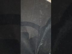 Titanium implantaten ondersteunde prothesen Precise Ivoclar Prothese Over Implantaten