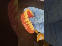 Volledige bovenste en onderste standplaat Acrylische gedeeltelijke tandvlees Ivoclar Tanden Roze kauwgom