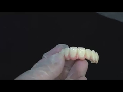 Porselein All On Four Zirconia brug hoge esthetiek tandheelkundige implantaat brug